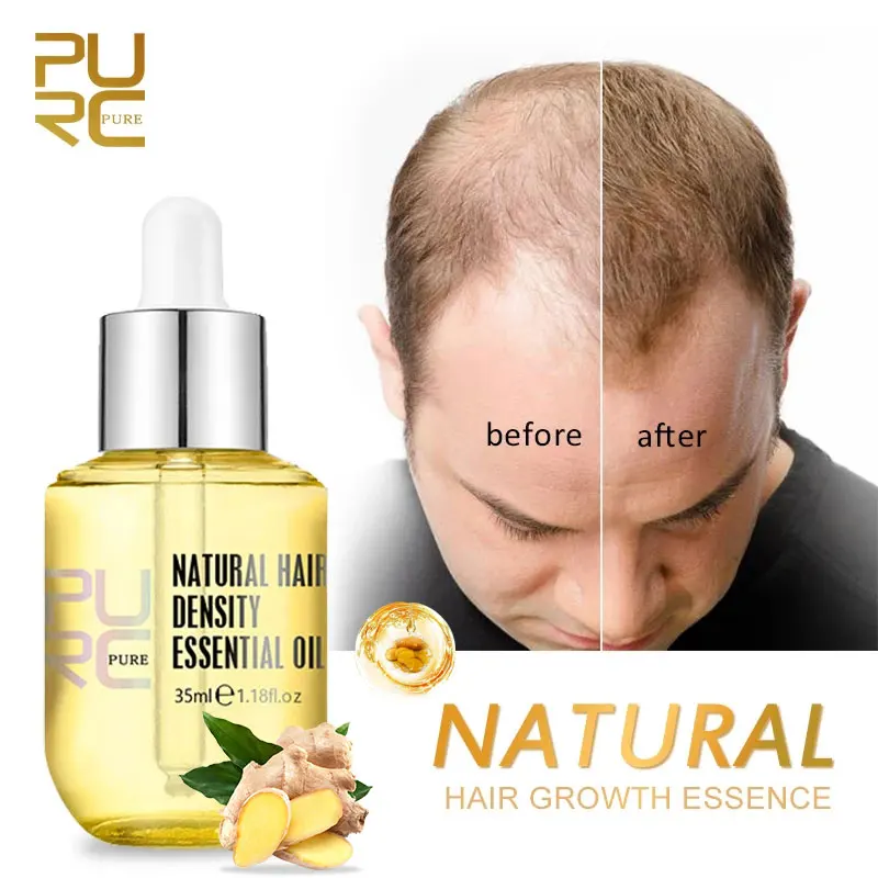 PURC טבעי צמיחת השיער המהות מעבה לצמיחה מחודשת סרום טיפולי שמן מהר לגדול שיער על נשירת שיער, מוצרי טיפוח לגברים & נשים