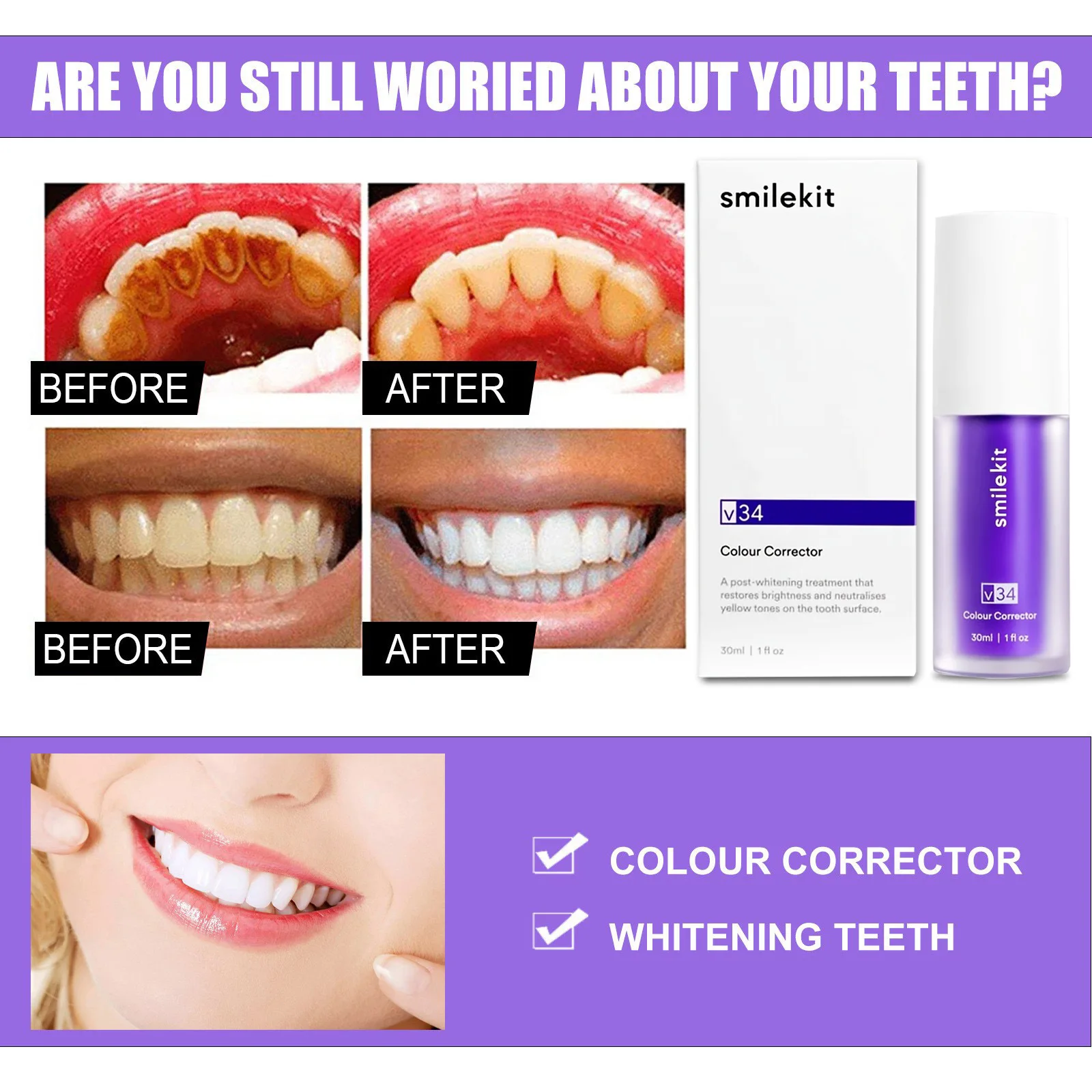 v34 תיקון צבע סגול שיניים הלבנת שיניים הסרת כתמים הלבנת שיניים שועל סגול משחת שיניים תיקון צבע
