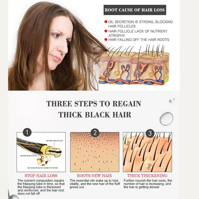 ג ' ינג ' ר במהירות צמיחת השיער שמן אתרי טבעי נגד נשירת שיער, מוצרי טיפוח שיער צמיחת שיער שמנים אתריים נשירת שיער דליל