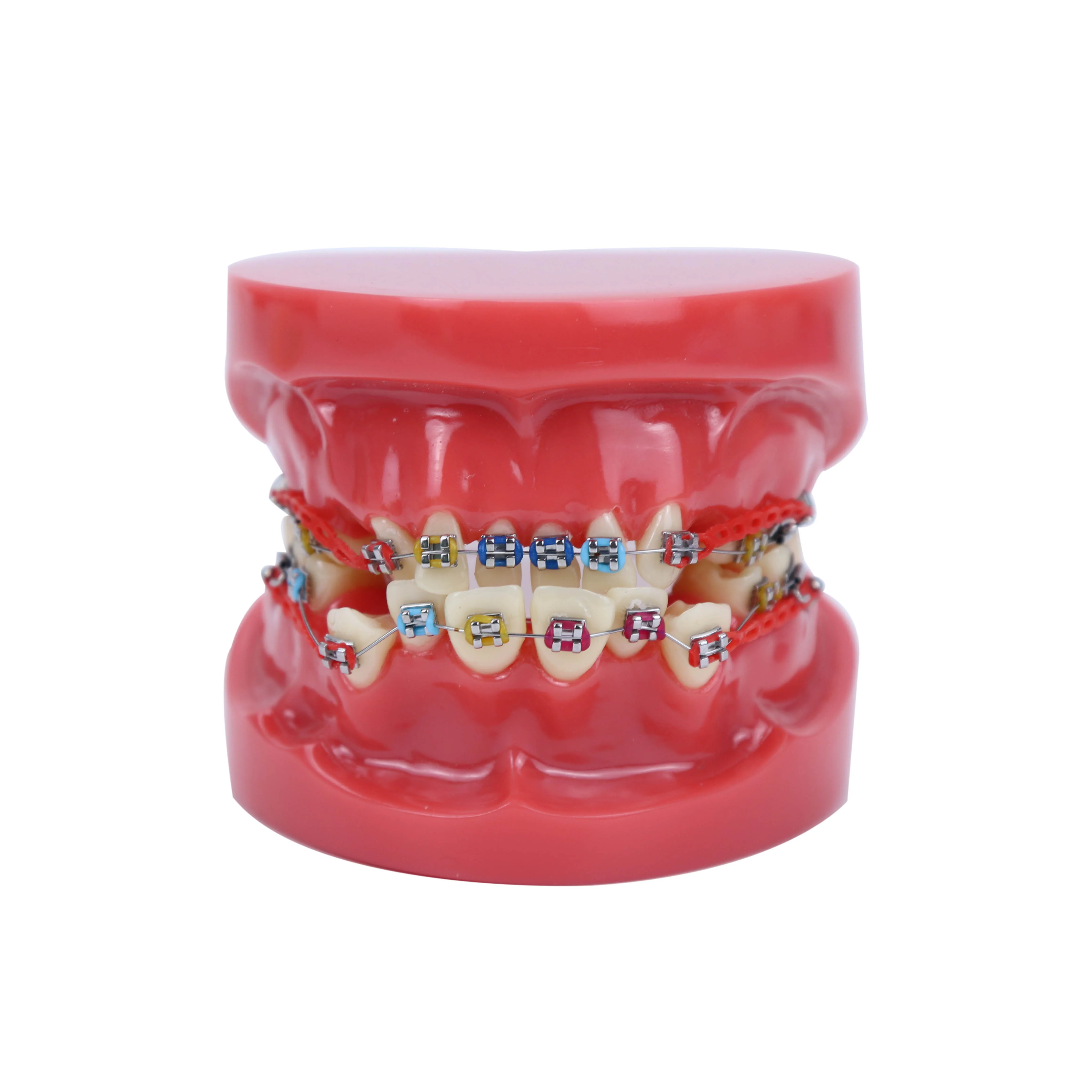 שיניים אורתודונטיה שיניים דגם מתכת הסוגר קשת חוט תיקון אורתודונטי דגם עם שיניים סוגריים