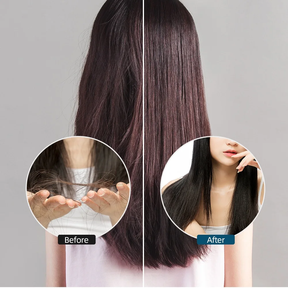לייזר אינפרא אדום צמיחת השיער עיסוי מסרק שיער הקרקפת המוליך המסרק לעיסוי לצמיחה מחודשת שיער טיפול מברשת נגד נשירת שיער
